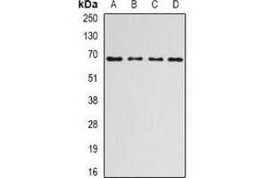 Western blot analysis of Ribophorin-1 expression in HepG2 (A), SKOV3 (B), mouse liver (C), rat liver (D) whole cell lysates. (RPN1 抗体)