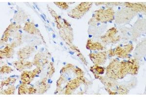 Immunohistochemistry of paraffin-embedded Rat heart using WSB2 Polyclonal Antibody at dilution of 1:100 (40x lens). (WSB2 抗体)