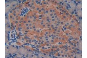 Detection of RSPO1 in Rat Pancreas Tissue using Polyclonal Antibody to R-Spondin 1 (RSPO1)