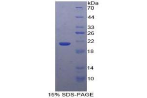 SDS-PAGE (SDS) image for Glucosidase, Alpha, Acid (GAA) ELISA Kit (ABIN6574146)