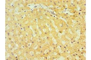 Immunohistochemistry of paraffin-embedded human liver tissue using ABIN7172813 at dilution of 1:100 (TBRG1 抗体  (AA 22-150))