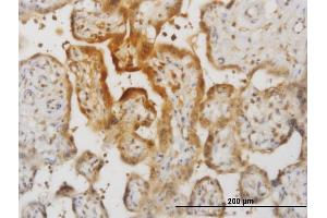 Immunoperoxidase of monoclonal antibody to IL15 on formalin-fixed paraffin-embedded human placenta. (IL-15 抗体  (AA 49-162))