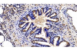 Detection of EPCR in Rat Lung Tissue using Polyclonal Antibody to Endothelial protein C receptor (EPCR) (PROCR 抗体  (AA 59-217))