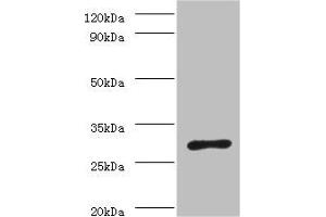 Western blot All lanes: ureA antibody at 2 μg/mL + Helicobacter pylori bacteria liquid Secondary Goat polyclonal to rabbit IgG at 1/10000 dilution Predicted band size: 27 kDa Observed band size: 27 kDa (Urea (AA 1-238) 抗体)