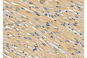 ABIN6261126 and ABIN6277912 at 1/100 staining Rat heart tissue by IHC-P.