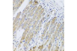 Immunohistochemistry of paraffin-embedded mouse stomach using RARS2 antibody.