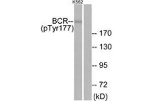 Western blot analysis of extracts from K562 cells, using Bcr (Phospho-Tyr177) Antibody. (BCR 抗体  (pTyr177))