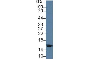 Detection of HBd in Human Blood Cells lysate using Polyclonal Antibody to Hemoglobin Delta (HBd) (HBd 抗体  (AA 1-143))