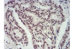 Immunohistochemistry (IHC) image for anti-Chromobox Homolog 4 (CBX4) (AA 397-514) antibody (ABIN5883842) (CBX4 抗体  (AA 397-514))