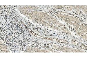 IHC analysis of FLCN using anti-FLCN antibody (ABIN7602491). (FLCN 抗体  (AA 8-551))