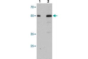 Western blot analysis of SDPR in HeLa cell lysate with SDPR polyclonal antibody  at (lane 1) 1 and (lane 2) 2 ug/mL. (SDPR 抗体  (N-Term))