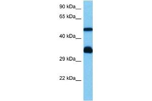 Host:  Mouse  Target Name:  HCLS1  Sample Tissue:  Mouse Heart  Antibody Dilution:  1ug/ml (HCLS1 抗体  (N-Term))