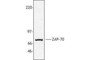 Western Blotting (WB) image for anti-zeta-Chain (TCR) Associated Protein Kinase 70kDa (ZAP70) antibody (ABIN2665463) (ZAP70 抗体)