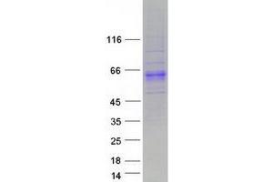 Validation with Western Blot