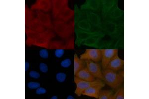 TST Mouse Monoclonal Antibody staining Hela cells by IF/ICC. (TST 抗体)