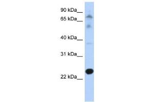 CHIC2 antibody used at 1 ug/ml to detect target protein. (CHIC2 抗体  (N-Term))