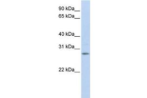 IGFBP4 antibody used at 1 ug/ml to detect target protein. (IGFBP4 抗体  (Middle Region))