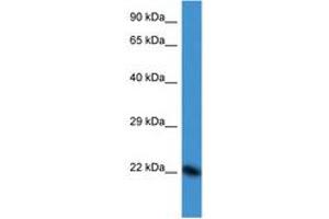 Image no. 1 for anti-Double Homeobox 3 (DUX3) (N-Term) antibody (ABIN6747565) (DUX3 抗体  (N-Term))