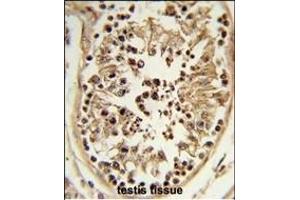 Formalin-fixed and paraffin-embedded human testis tissue reacted with CHPF Antibody (Center), which was peroxidase-conjugated to the secondary antibody, followed by DAB staining. (CHPF 抗体  (AA 327-354))