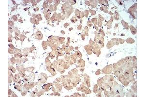 Immunohistochemical analysis of paraffin-embedded cardiac muscle tissues using ATG13 mouse mAb with DAB staining.