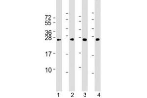 Western blot testing of human 1) HeLa, 2) HepG2, 3) Jurkat and 4) mouse NIH3T3 cell lysate with RAB5B antibody at 1:2000. (RAB5B 抗体)