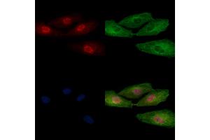 ABIN6256959 and ABIN6274926 staining  cells by IF/ICC. (BCAS2 抗体  (Internal Region))