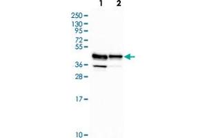 Western blot analysis of Lane 1: Human cell line RT-4 Lane 2: Human cell line U-251MG with RCN3 polyclonal antibody  at 1:500-1:1000 dilution. (RCN3 抗体)