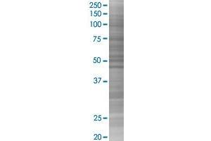 Western Blotting (WB) image for DSG1 293T Cell Transient Overexpression Lysate(Denatured) (ABIN1331616)