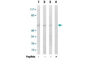 Western blot analysis of extracts from COLO cells (Lane 1), HUVEC cells (Lane 2 and lane 4) and MCF-7 cells (Lane 3), using GRB14 polyclonal antibody . (GRB14 抗体)