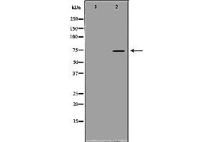 Western blot analysis of extracts of PC-3, using SCNN1B antibody. (SCNN1B 抗体  (C-Term))