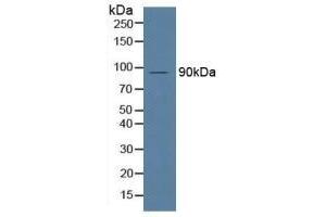 Detection of MPG1 in Human Serum using Polyclonal Antibody to Macrophage Expressed Gene 1 Protein (MPG1) (MPEG1 抗体  (AA 313-580))