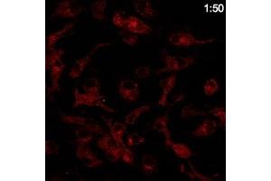 Immunofluorescence (IF) image for anti-RAB14, Member RAS Oncogene Family (RAB14) (C-Term) antibody (ABIN1439997)