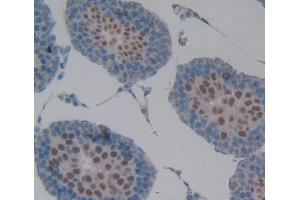 Used in DAB staining on fromalin fixed paraffin- embedded testis tissue (RNASEH2A 抗体  (AA 1-301))