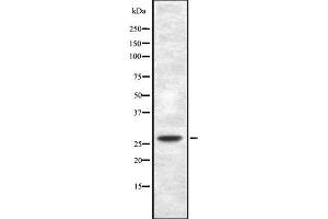 Western blot analysis of TP53INP1 using HepG2 whole cell lysates (TP53INP1 抗体  (Internal Region))