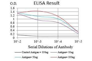 Black line: Control Antigen (100 ng), Purple line: Antigen(10 ng), Blue line: Antigen (50 ng), Red line: Antigen (100 ng), (CD22 抗体  (AA 621-725))