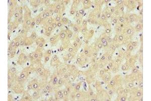 Immunohistochemistry of paraffin-embedded human liver tissue using ABIN7168635 at dilution of 1:100 (Sclerostin 抗体  (AA 24-213))