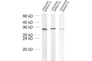 dilution: 1 : 1000, sample: crude synaptosomal fraction of rat brain (P2) (Syntaxin 1B 抗体  (AA 171-187))