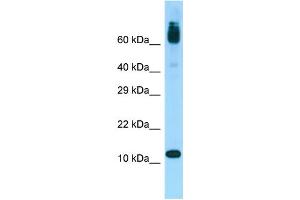 Western Blotting (WB) image for anti-Acylphosphatase 1, Erythrocyte (Common) Type (Acyp1) (Middle Region) antibody (ABIN2790603)