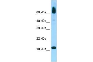 WB Suggested Anti-ACYP1 Antibody Titration: 1.