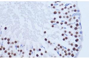 Immunohistochemistry of paraffin-embedded Rat testis using MATR3 Polyclonal Antibody at dilution of 1:100 (40x lens). (MATR3 抗体)