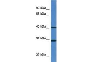 Image no. 1 for anti-Histocompatibility 13 (H13) (AA 240-289) antibody (ABIN6746312) (H13 抗体  (AA 240-289))