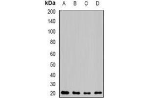 Western blot analysis of NAT5 expression in MCF7 (A), mouse kidney (B), mouse heart (C), rat lung (D) whole cell lysates. (NAT5 抗体)