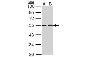 WB Image Sample (30 ug of whole cell lysate) A: A431 , B: H1299 10% SDS PAGE antibody diluted at 1:5000 (RUVBL2 抗体  (C-Term))