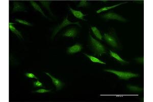 Immunofluorescence of monoclonal antibody to KRT8 on HeLa cell.