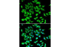 Immunofluorescence analysis of HeLa cell using NFATC3 antibody. (NFATC3 抗体)