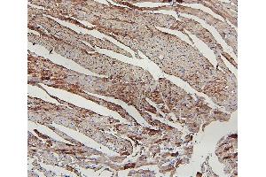 IHC analysis of LPP using anti-LPP antibody (ABIN7599606).