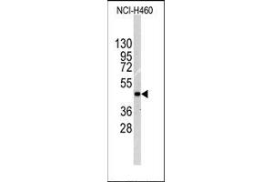 Image no. 1 for anti-Integrin-Linked Kinase (ILK) (Thr173) antibody (ABIN359883) (ILK 抗体  (Thr173))
