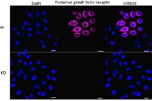 Immunocytochemical staining of HepG2 cells using Epidermal growth factor receptor antibody (ABIN7798472), 1:1,000), Top panel: wild-type (WT), Bottom panal: Adiponectin receptor 1 shRNA knockdown (KD).