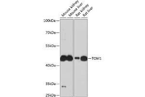 Western blot analysis of extracts of various cell lines, using TOM1 antibody (ABIN6128832, ABIN6149379, ABIN6149380 and ABIN6224955) at 1:3000 dilution. (TOM1 抗体  (AA 314-493))