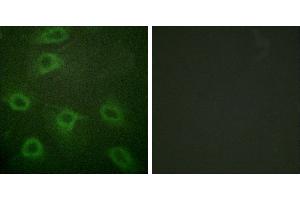 P-peptide - +Immunofluorescence analysis of HeLa cells, using BAD (Phospho-Ser134) antibody. (BAD 抗体  (pSer134))